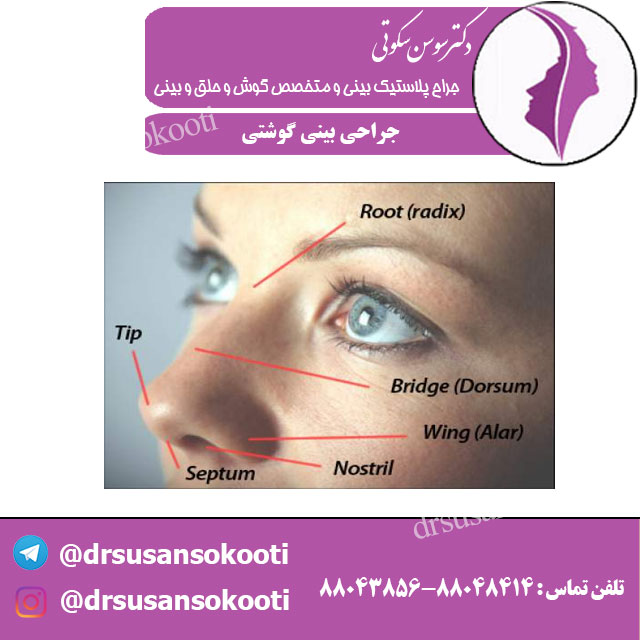 جراحی بینی گوشتی