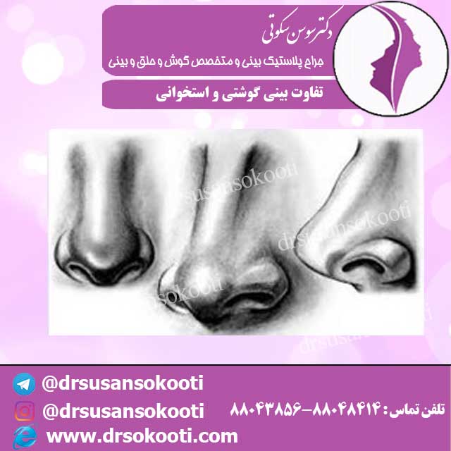 تفاوت بینی گوشتی و استخوانی
