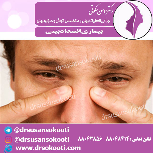 بیماری انسداد بینی