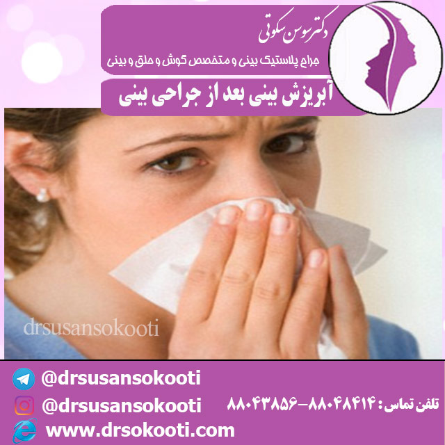 آبریزش بینی بعد از جراحی بینی