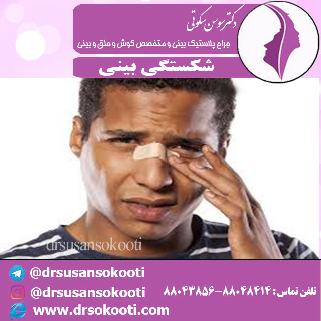 شکستگی بینی