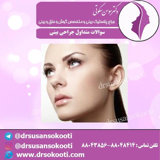 سوالات متداول جراحی بینی