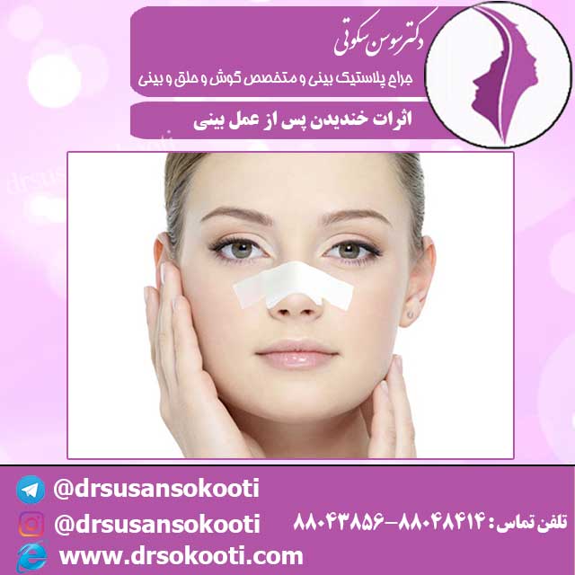 اثرات خندیدن پس عمل بینی