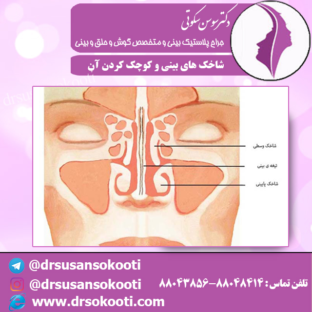 شاخک های بینی و کوچک کردن آن