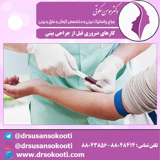 کارهای ضروری قبل از جراحی بینی