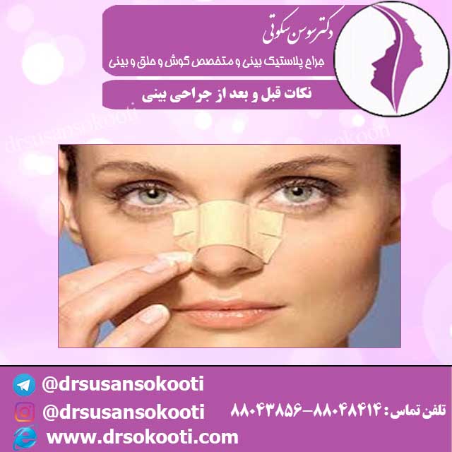 نکات قبل و بعد از جراحی بینی