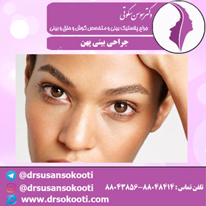 جراحی بینی پهن