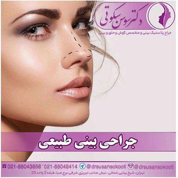جراحی بینی طبیعی