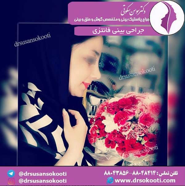 جراحی بینی فانتزی