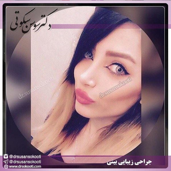 جراح بینی