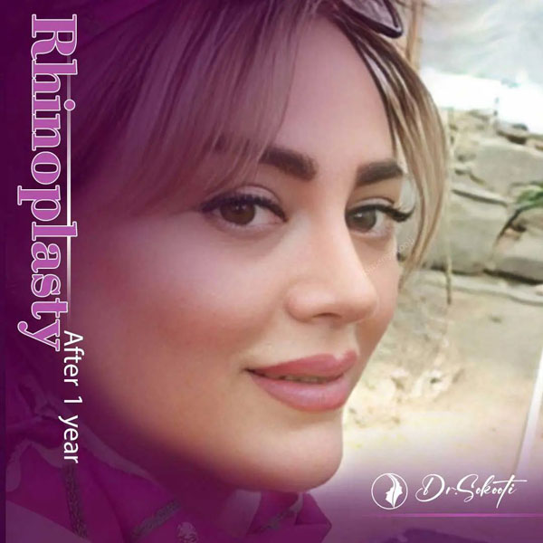 عمل زیبایی بینی
