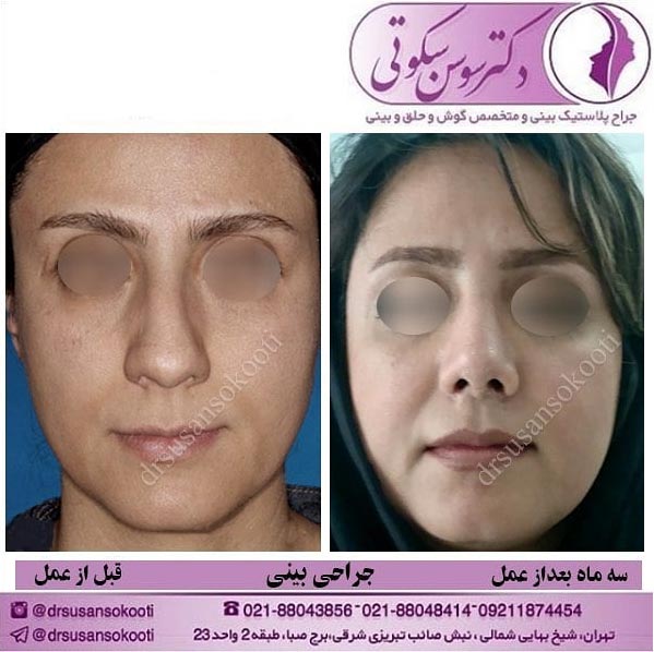 بهترین پزشک جراح بینی تهران