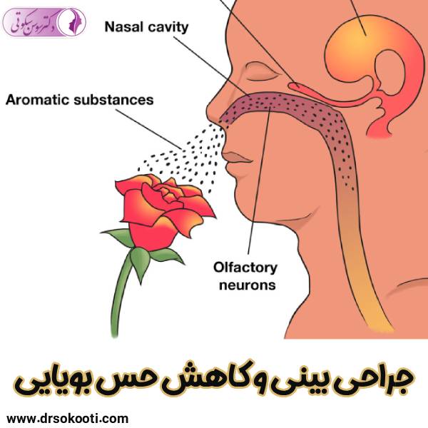 جراحی بینی و کاهش حس بویایی - دکتر سوسن سکوتی