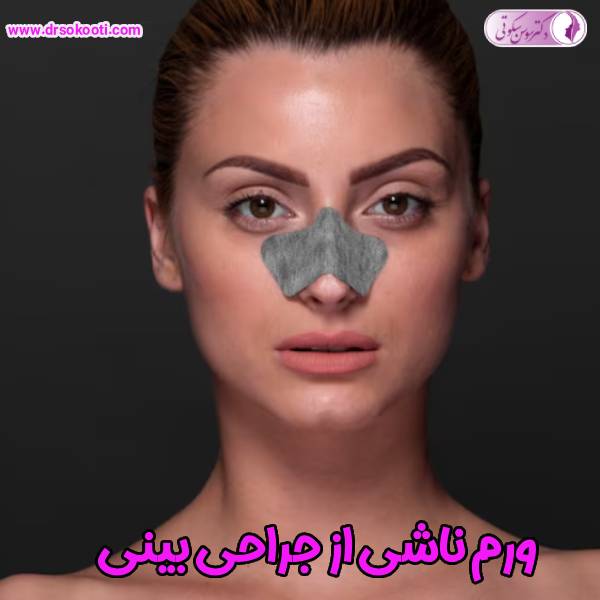 ورم ناشی از جراحی بینی