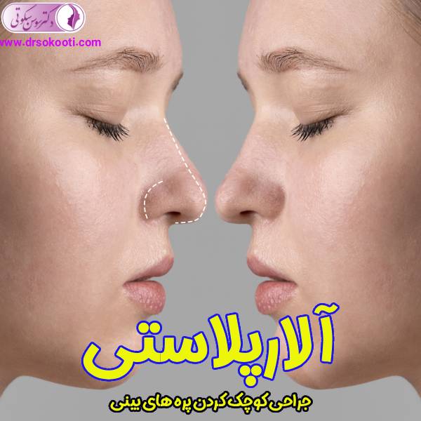 آلارپلاستی - دکتر سوسن سکوتی