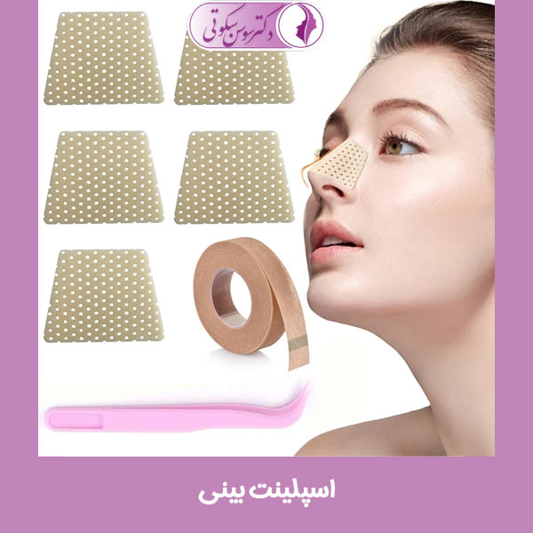 اسپلینت بینی