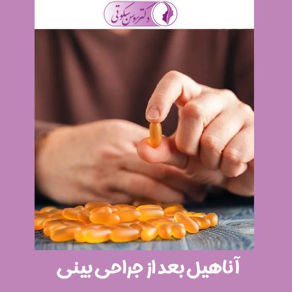 آناهیل بعد از جراحی بینی