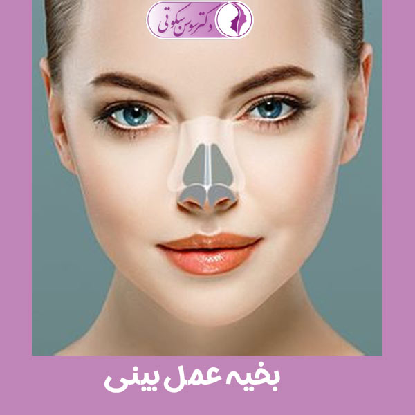 بخیه عمل بینی