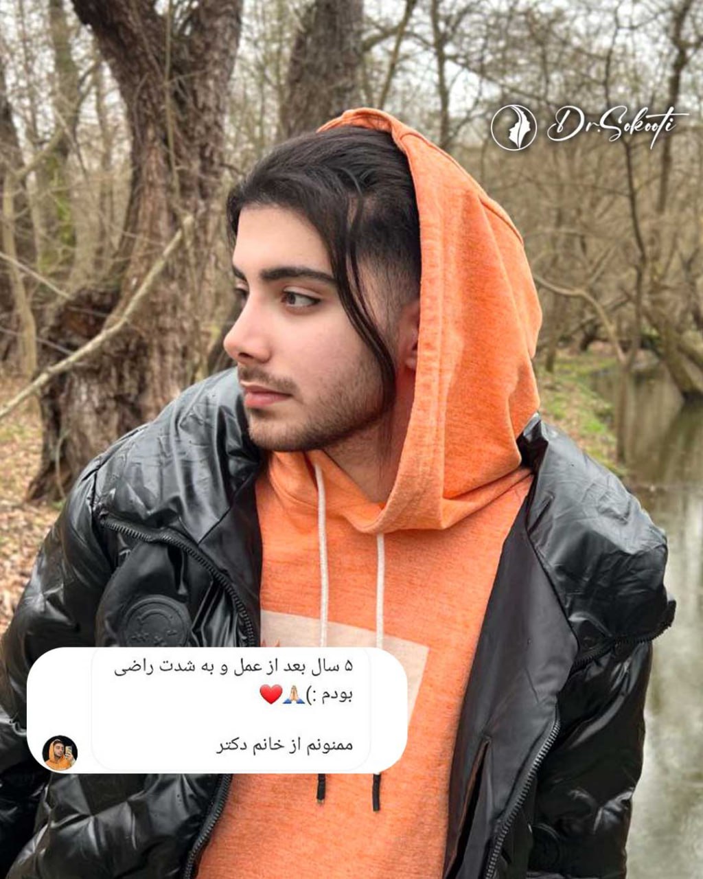 جراحی بینی طبیعی
