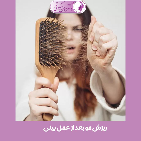 ریزش مو بعد از عمل بینی