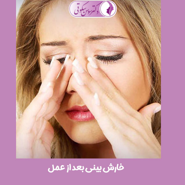 خارش بینی بعد از عمل